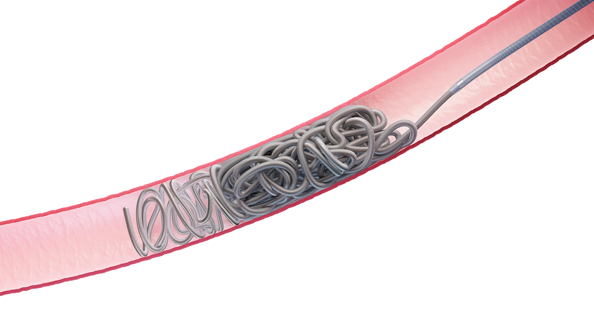 Image of Hydropack coil in a vessel