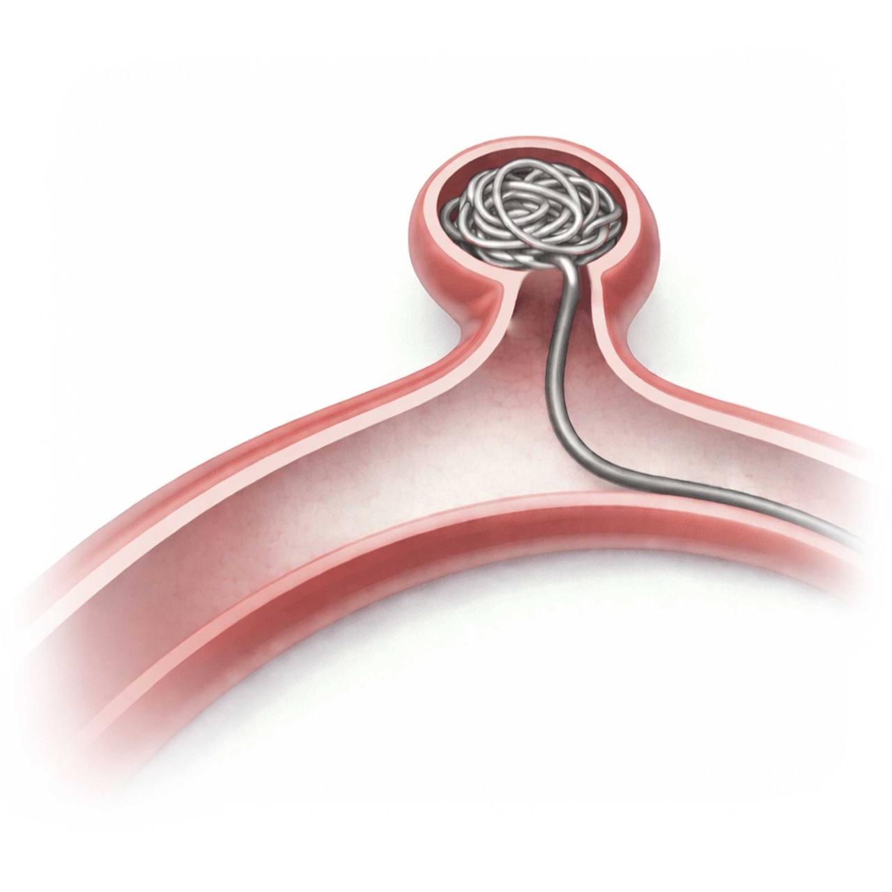 Embolization Training and Education