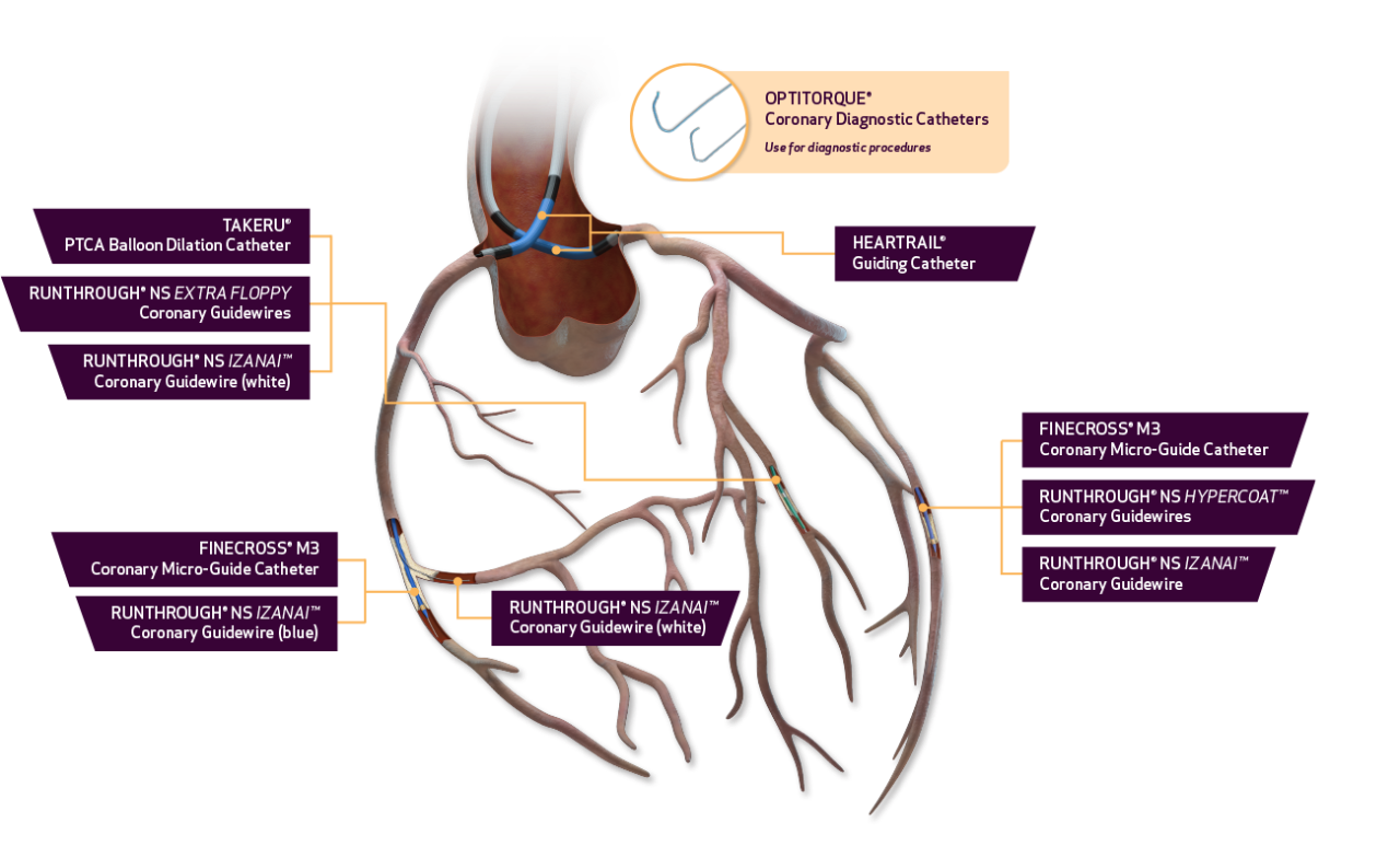 View complex coronary heart image