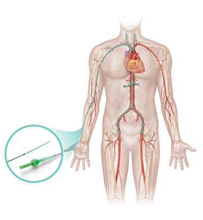 R2P Destination Slender product close-up and pathways through the human body