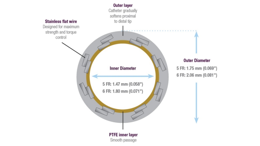 Cross-section image of R2P Slenguide with stainless flat wire, outer layer, outer diameter, inner diameter and PTFE inner layer Cross-section image of R2P Slenguide with stainless flat wire, outer layer, outer diameter, inner diameter and PTFE inner layer