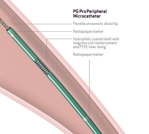 View PG Pro™ Peripheral Microcatheter See the PG Pro™ Peripheral Microcatheter