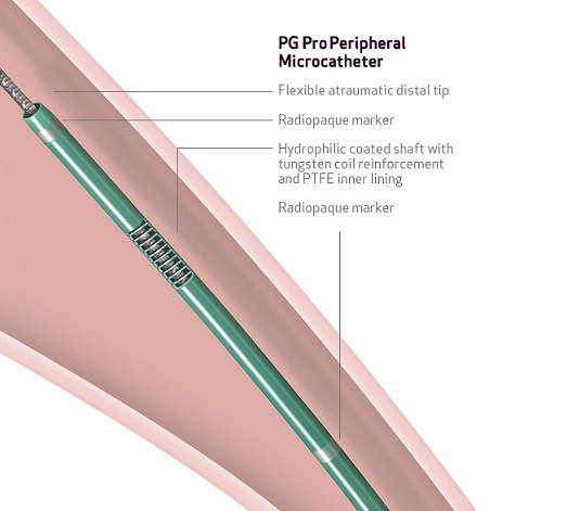 See the PG Pro™ Peripheral Microcatheter