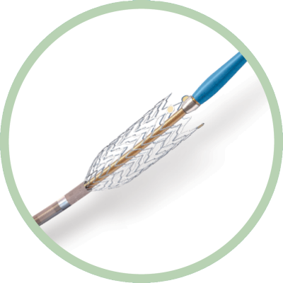  Image of R2P Misago peripheral stent